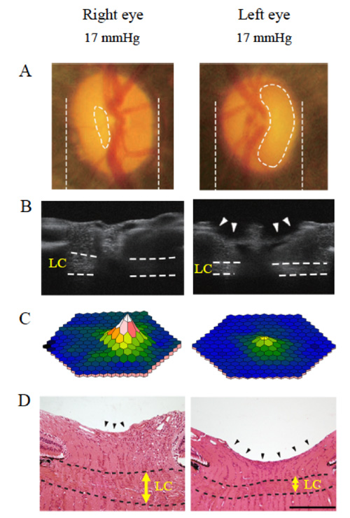 Figure：A 12 years-old female marmoset presenting with normal tension glaucoma-like phenotypes.