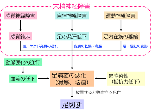 糖尿病合併症 身近な医学研究情報 公益財団法人 東京都医学総合研究所