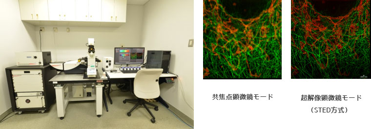 超解像蛍光顕微鏡