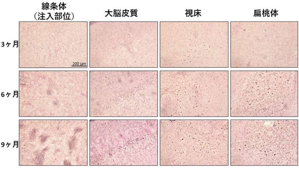 図3.AD線維注入マウスにおけるタウ蓄積病理の形成と伝播