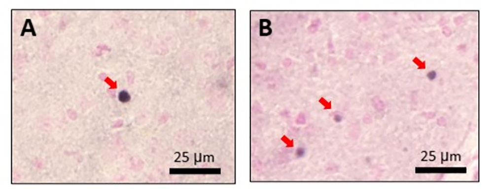 図4.PiD線維注入マウスにおけるピック球様タウの蓄積