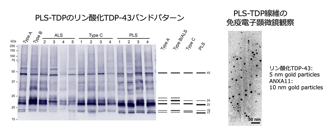 図2 PLS-TDPの生化学的特徴