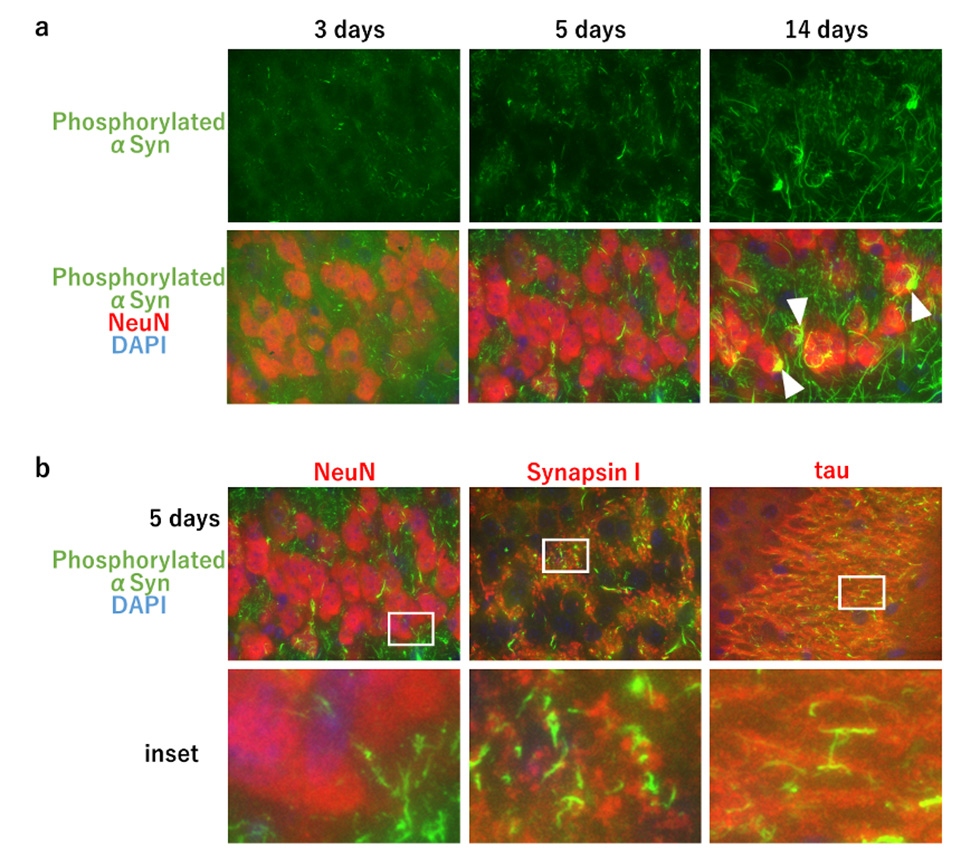 Figure1 Seed-dependent accumulation of phosphorylated alpha-synuclein in the brain of wild-type mice