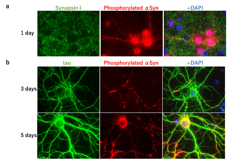 Figure2 Seed-dependent phosphorylation of α-synuclein in mouse primary-cultured neurons.
