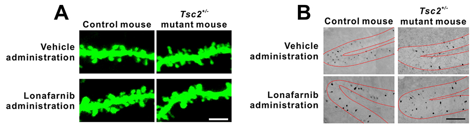 Figure 1：Neuronal alteration in Tsc2+/- mice and the effect of lonafarnib administration.