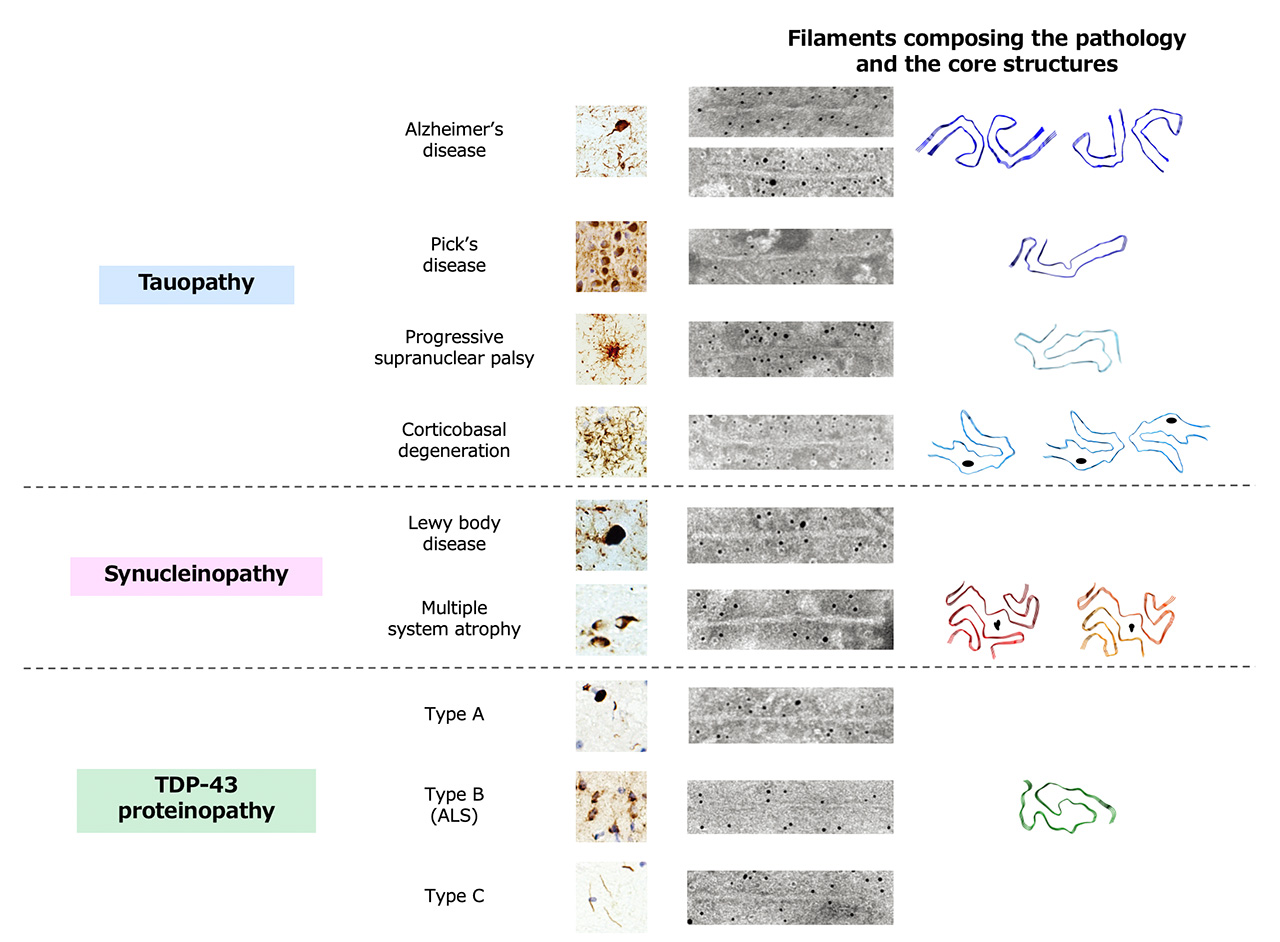 Figure1 Seed-dependent accumulation of phosphorylated alpha-synuclein in the brain of wild-type mice