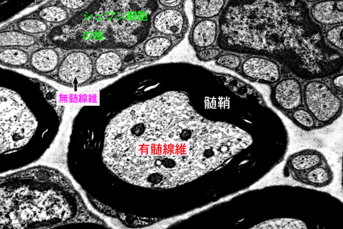 図10. 有髄線維と無髄線維の電子顕微鏡像
