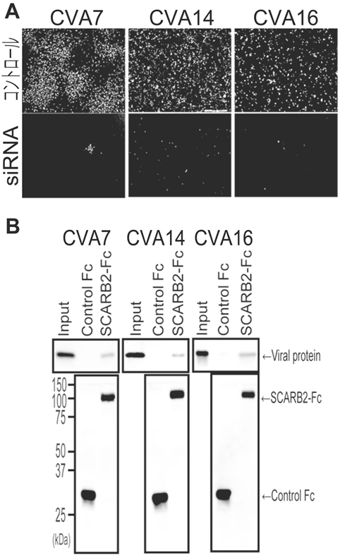 図１：CVA7、CVA14およびCVA16はSCARB2を感染受容体としている