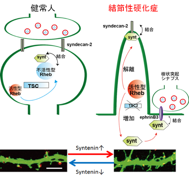 図2．結節性硬化症における樹状突起スパイン形成不全のメカニズム