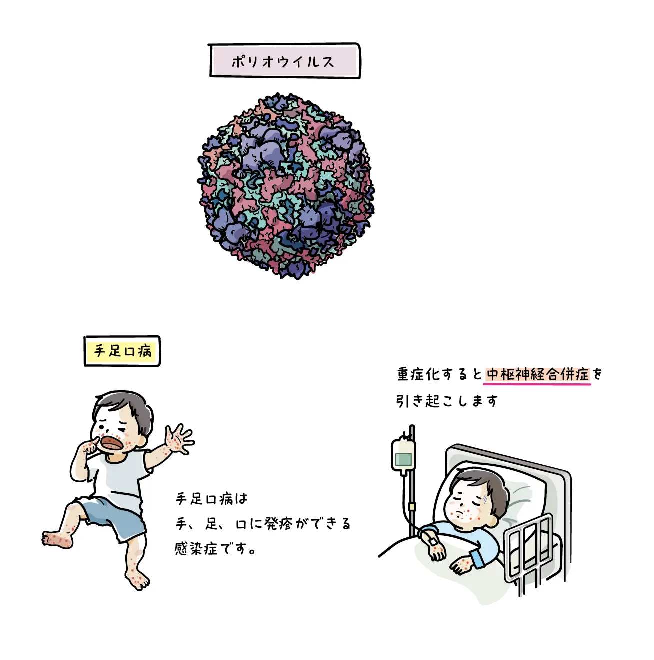 ポリオウイルス、手足口病