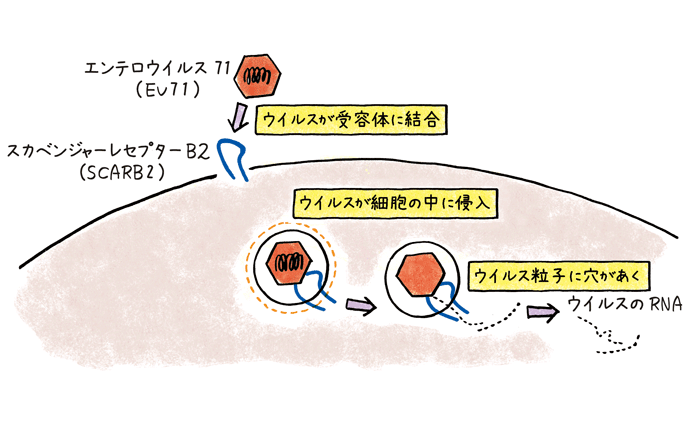 エンテロウイルス