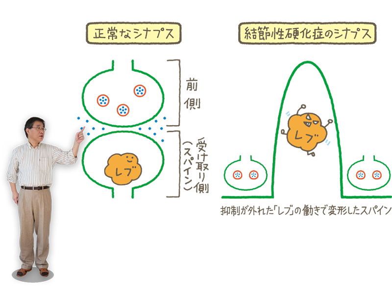 結節性硬化症のシナプス