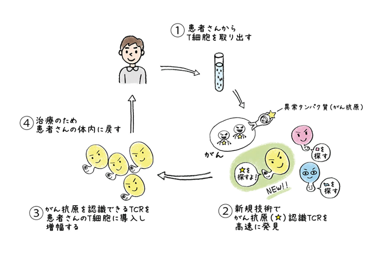 体の中からがん細胞を殺傷するTCRを見つけて増幅し、患者さんの体内に戻す