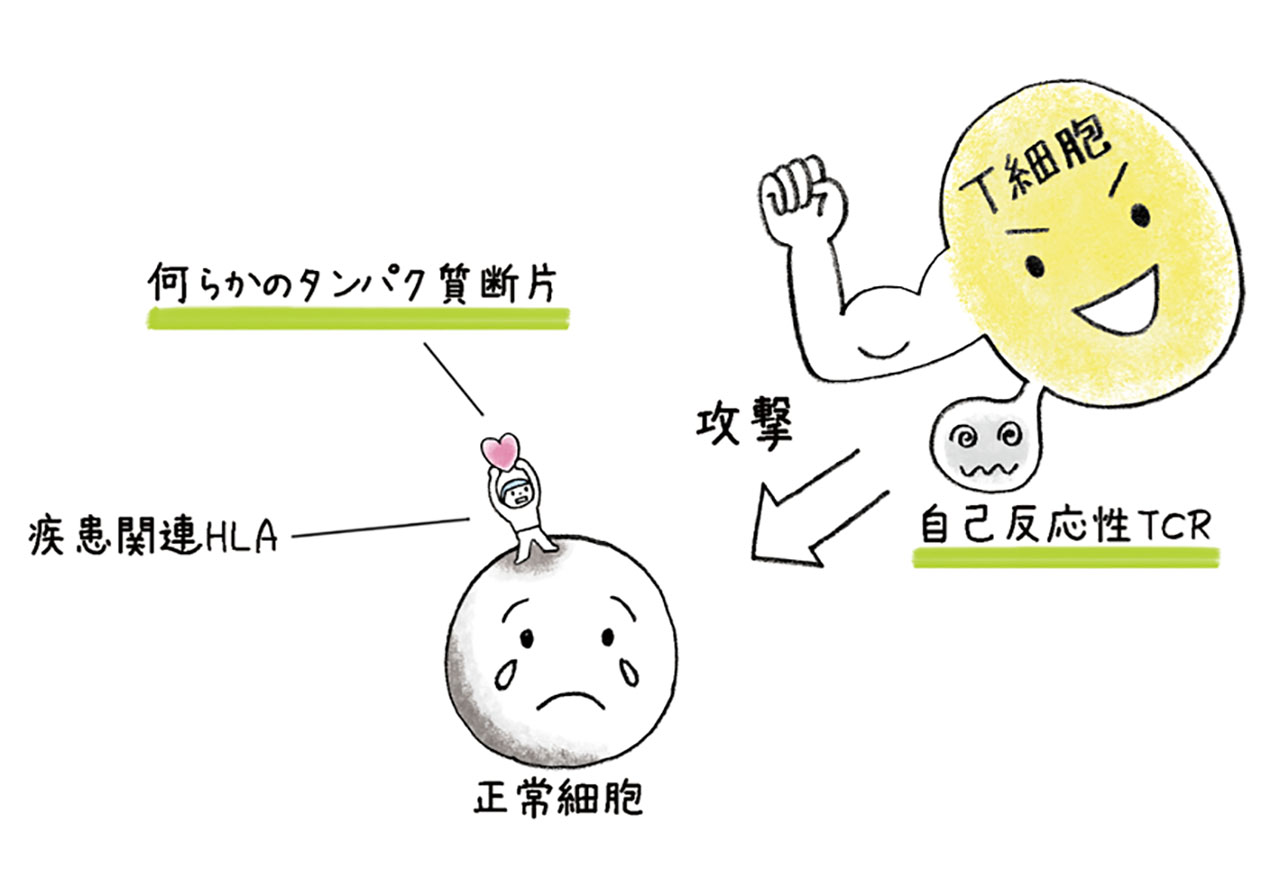 自己免疫疾患では、何らかのタンパク質断片-HLA複合体をTCRが誤って認識してしまい、正常な細胞が壊されてしまう例がある