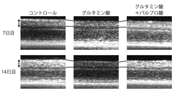 図1 バルプロ酸による網膜変性の抑制効果