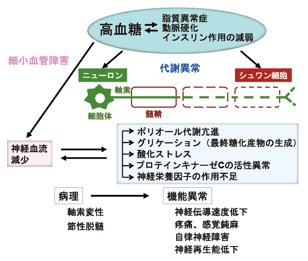 図1 想定される糖尿病性神経障害の成因