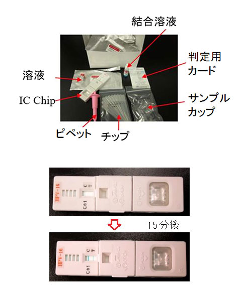 パピローマウイルス16・18型に対する血中抗体価測定