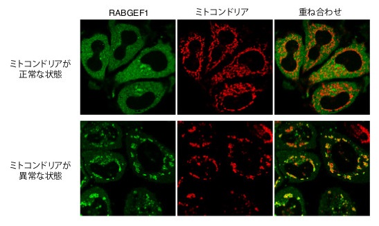 不良ミトコンドリアに局在化するRABGEF1