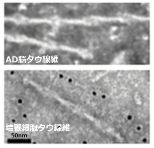 上：アルツハイマー病(AD)患者脳から抽出したタウ線維，下：ADタウを導入した培養細胞の中で形成されたタウ線維
