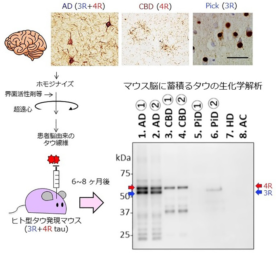 図2 患者脳タウ線維をヒト型タウマウス脳に接種するモデル