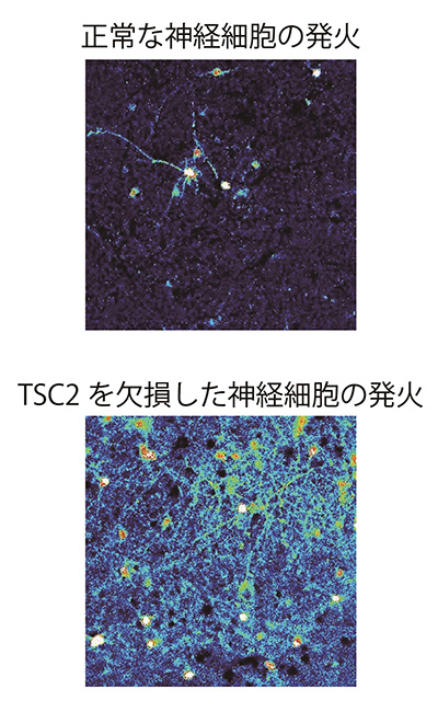 図 正常型とTSC2欠損型の神経細胞の活動の違い