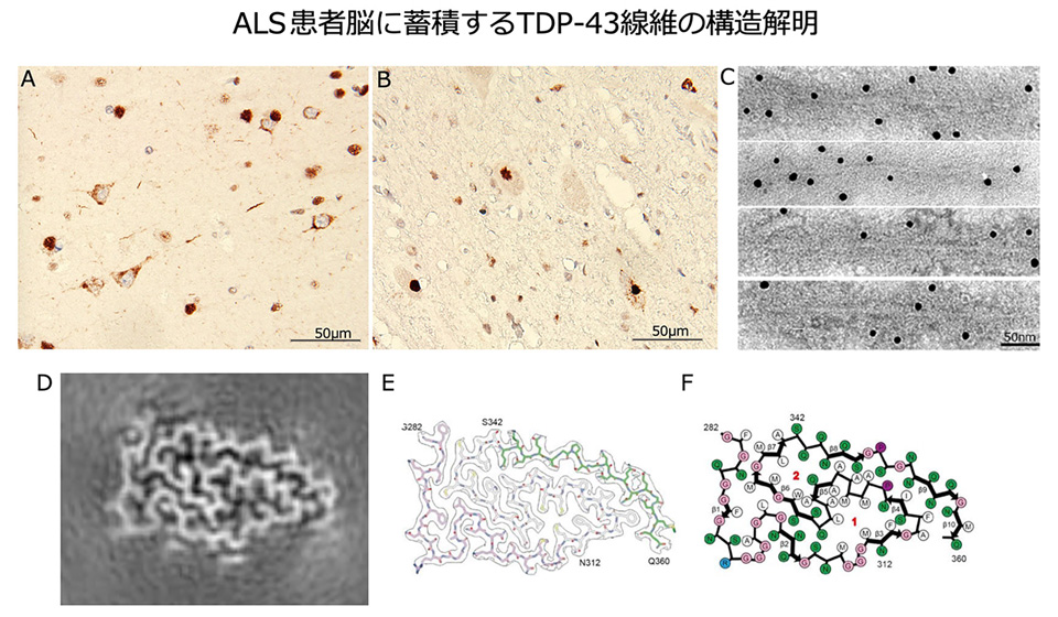ALS患者脳に蓄積するTDP-43繊維の構造解明
