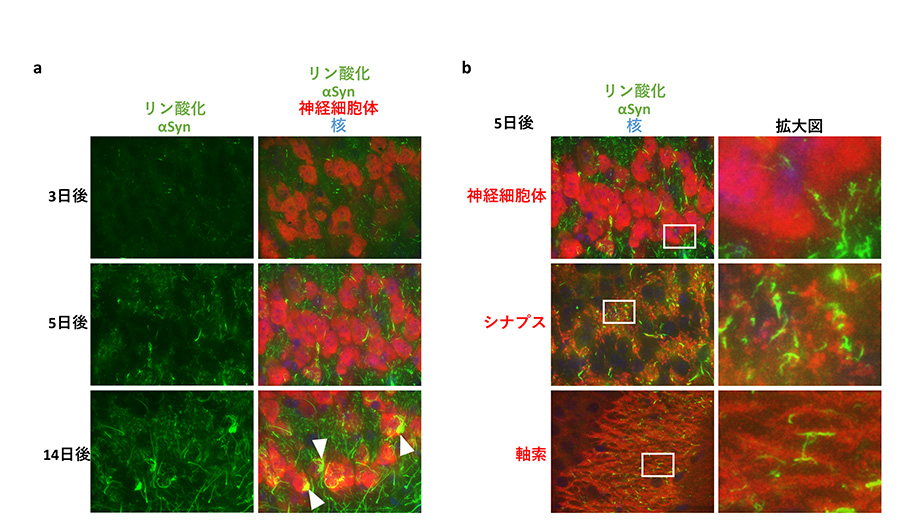 図　野生型マウス脳内におけるシード依存的なリン酸化αシヌクレインの局在変化