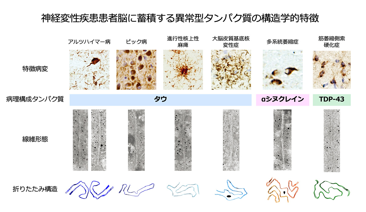 図. 神経変性疾患患者脳に蓄積する異常型タンパク質の構造学的特徴