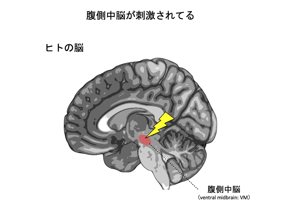 腹側中脳