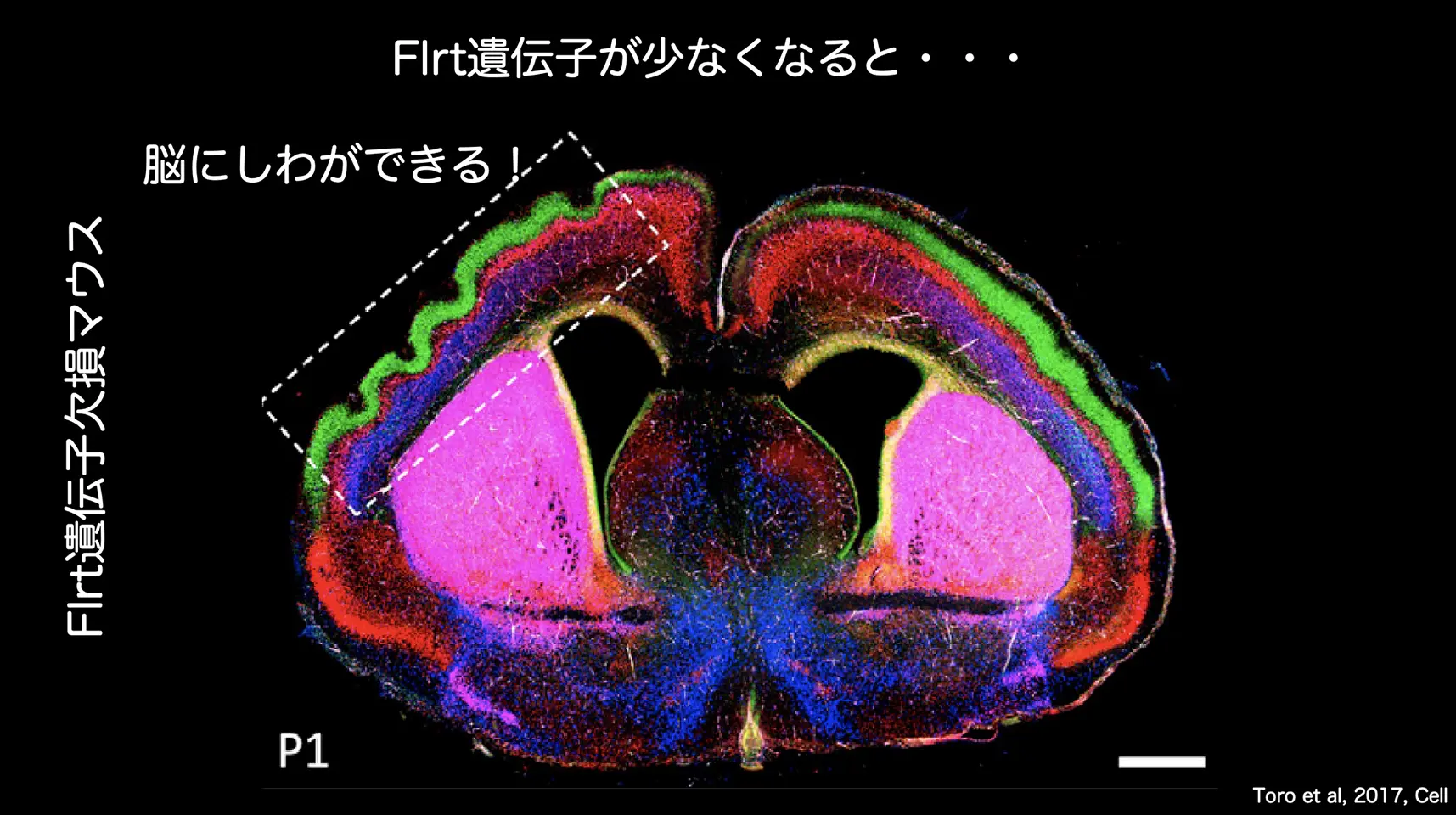 Flrt遺伝子が少なくなると・・・