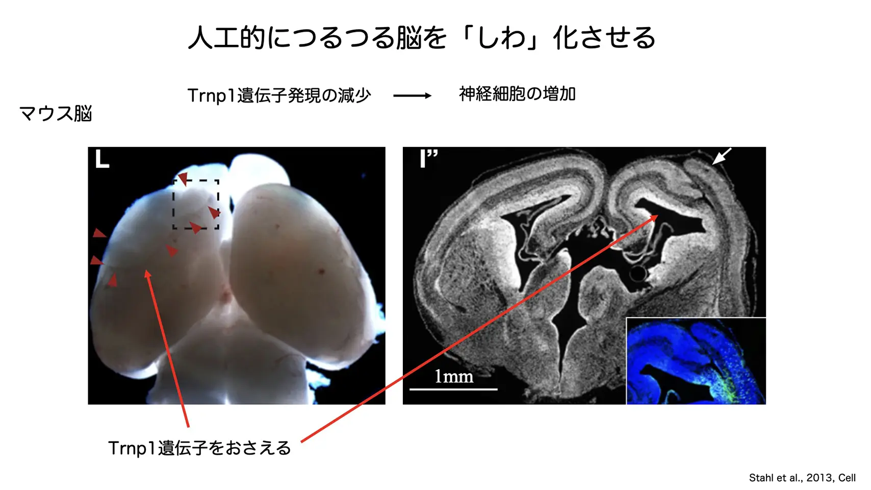 人工的につるつる脳を「しわ」化させる
