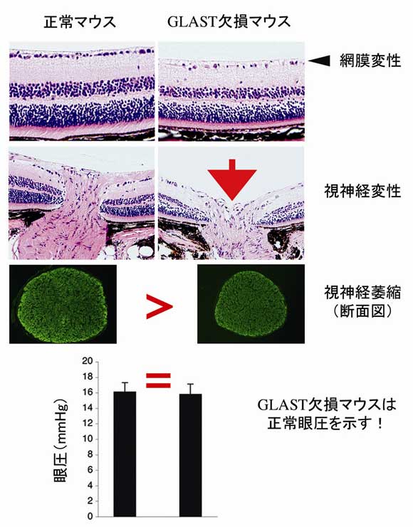 図3 GLAST欠損マウスにおける網膜・視神経変性