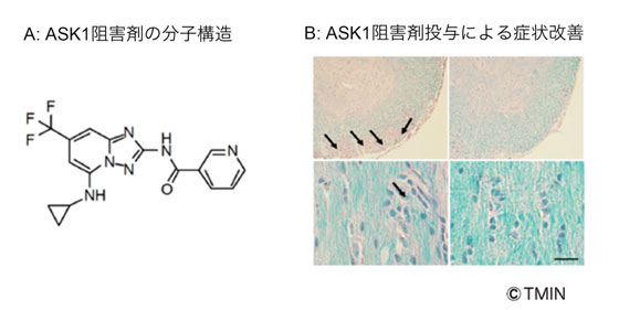 図3 新規薬物の開発と多発性硬化症モデル動物における治療効果