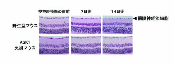 図2 ASK1が視神経損傷後の網膜神経節細胞死に与える影響