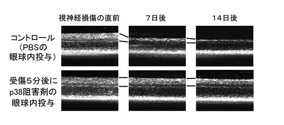 図3 薬剤による視神経損傷後の神経保護効果（同一眼における経時的観察）