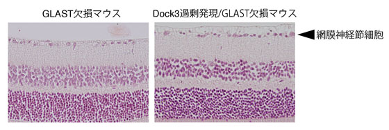 図2 Dock3が緑内障の進行に与える影響