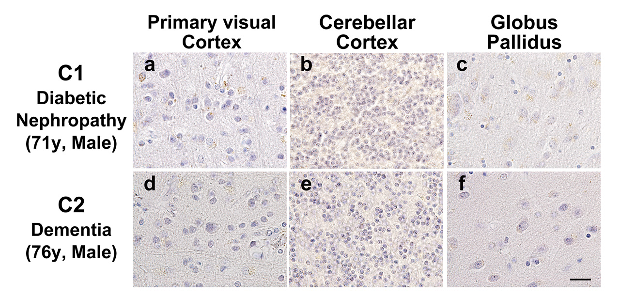 図3. 対照例（糖尿病性腎症患者および認知症患者）の一次視覚野、小脳皮質、大脳基底核にはペントシジン陽性神経細胞は認められなかった
