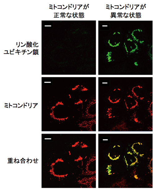 図２ リン酸化ユビキチン鎖の細胞内局在