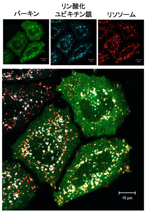 図３ リソソーム局在ユビキチンを導入した時のパーキンの局在変化