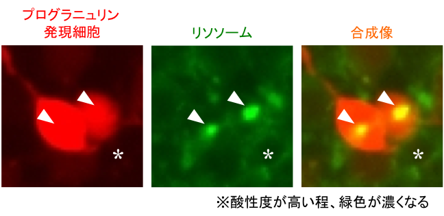 プログラニュリンの発現細胞