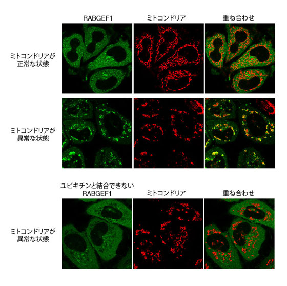 図1.不良ミトコンドリアに局在化するRABGEF1