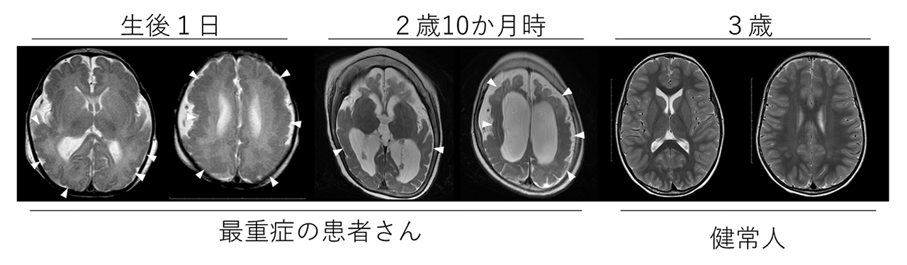 図1