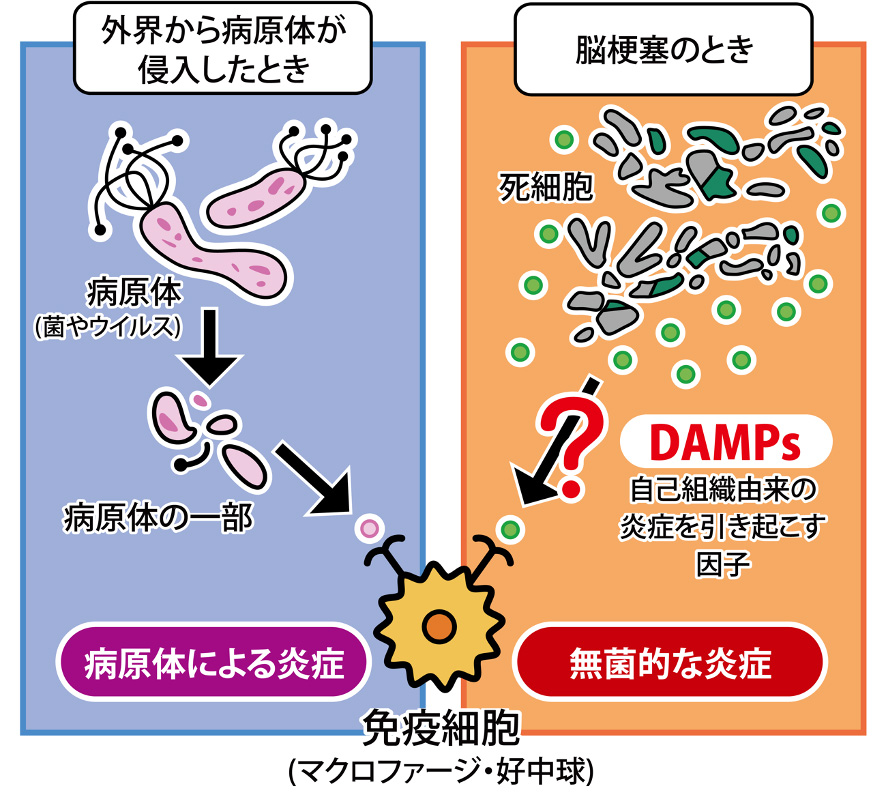 図1 脳梗塞ではDAMPsにより無菌的な炎症が引き起こされる