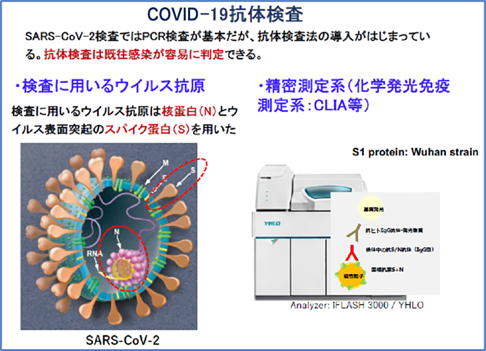 COVID-19抗体検査