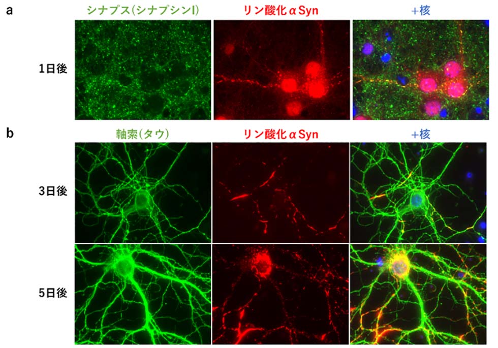 図2 初代培養細胞におけるシード依存的なリン酸化αシヌクレインの局在変化