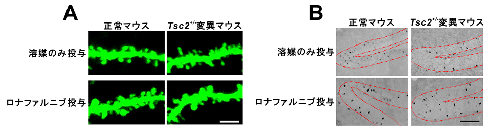 図1: Tsc2+/-/-変異マウスにおける神経の変化とロナファルニブ投与の影響