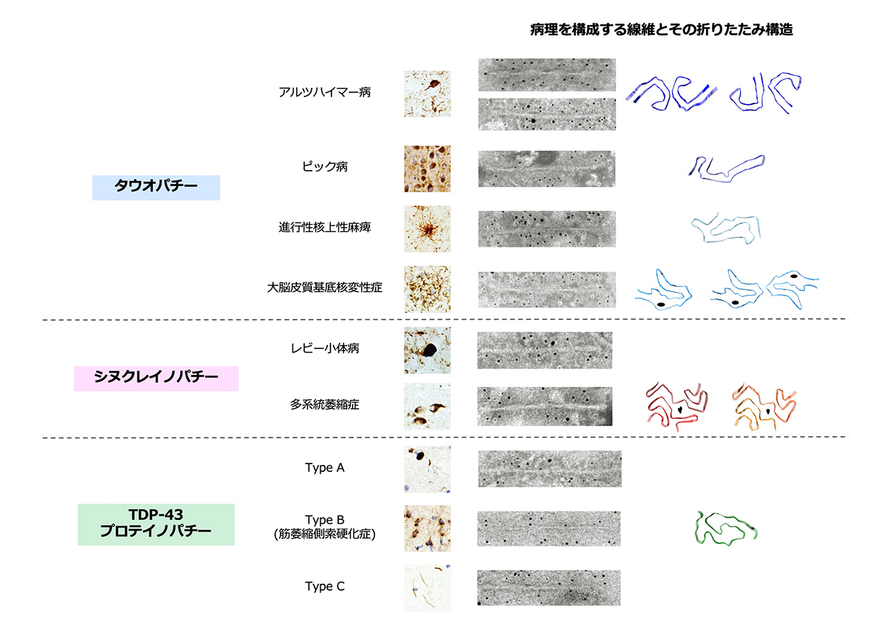 病理を構成する線維とその折りたたみ構造