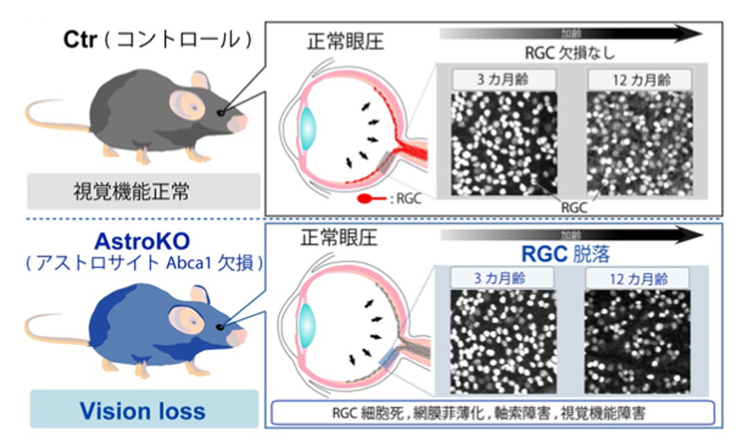 図1 アストロサイトのABCA1欠損による網膜の変化