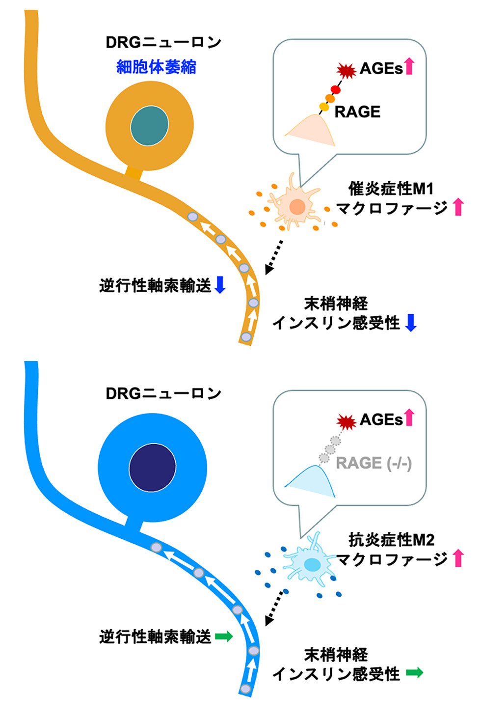 図 マクロファージAGEs-RAGEシグナルを介した糖尿病性神経障害の発症・増悪機構