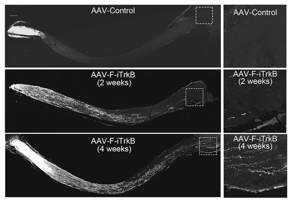 図3 視神経損傷モデルに対する遺伝子治療の視神経再生効果
